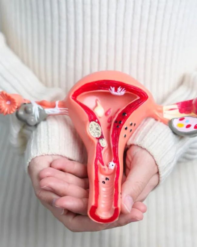Uterus Swelling Symptoms-1-2-3-4