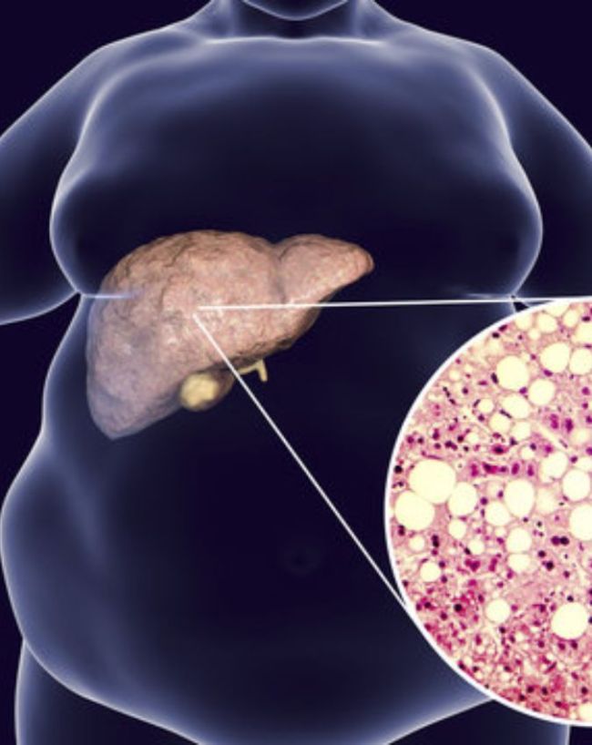 Liver Belly-1-2-3-4