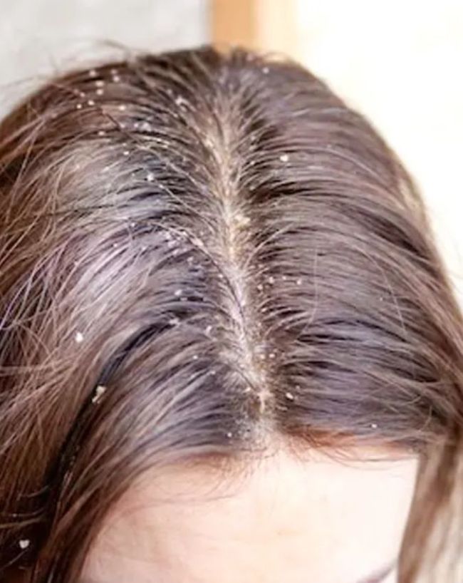 pigmentation, dermatologist advice-1-2-3-4