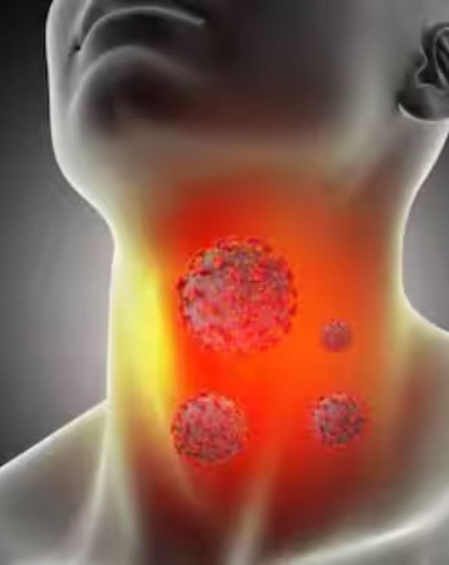 Throat Cancer Symptoms-1-2-3-4