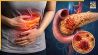 Pancreatic Cancer
