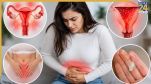 Uterus Swelling Symptoms