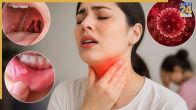 HIV Symptoms In Women