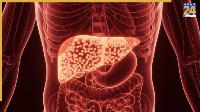 Foods for Fatty Liver
