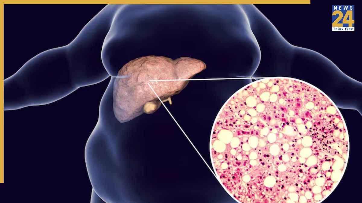 Fatty Liver में क्या पिएं? एम्स ट्रेंड डॉक्टर ने बताईं 5 हेल्दी ड्रिंक्स, डाइट में जरूर करें शामिल