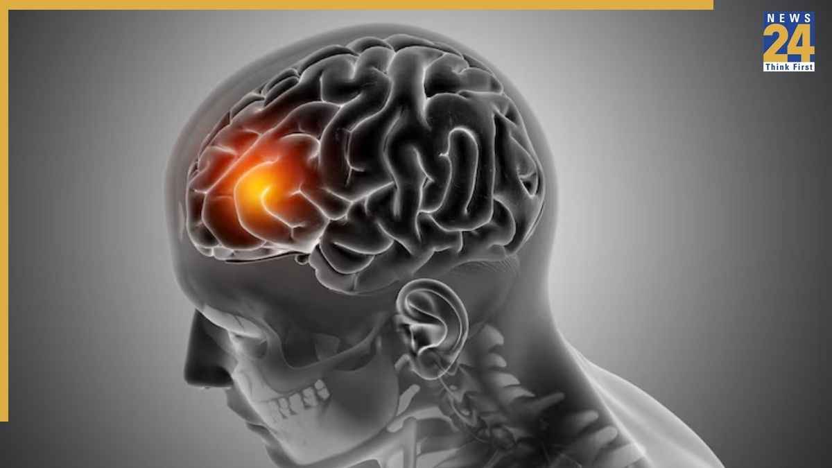 Which foods increase brain health Which foods increase brain health