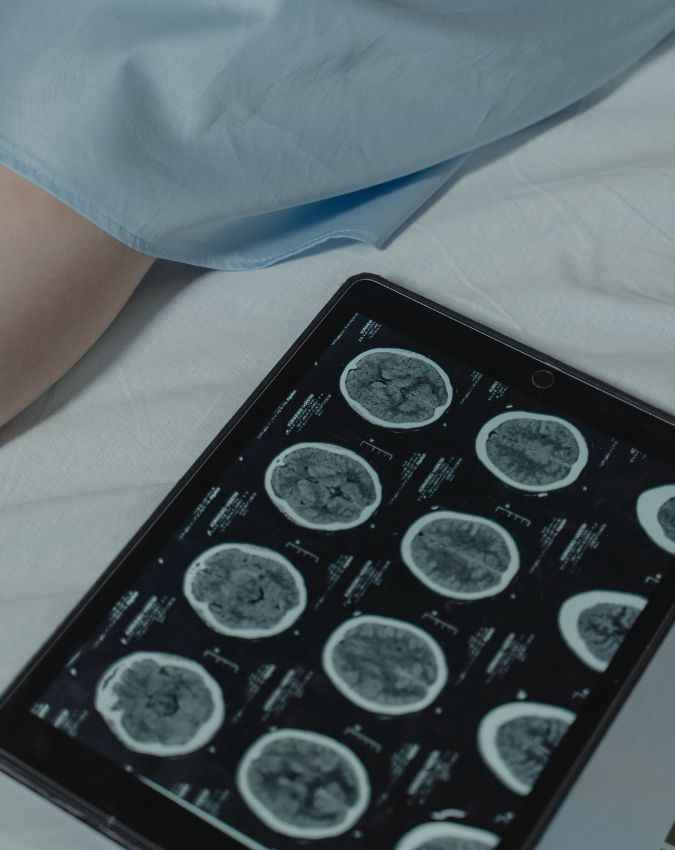 क्या बिनाइन ट्यूमर जानलेवा होते हैं? 