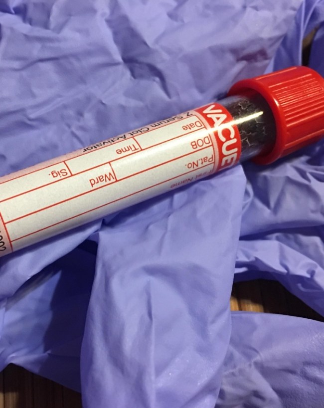 ApoB Blood Test For Heart-1-2-3-4