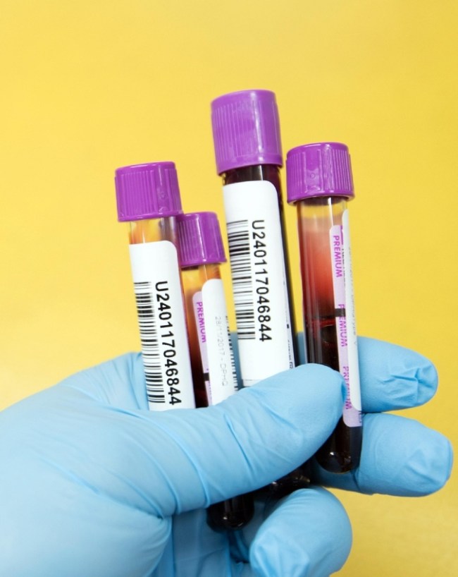ApoB Blood Test For Heart-1-2-3