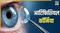 Artificial Cornea
