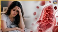 Unusual Anemia Symptoms