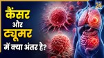 Are tumors the same as cancer