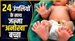 Baby Born With 24 Fingers