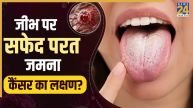 Cancer Symptoms On Tongue