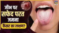 Cancer Symptoms On Tongue