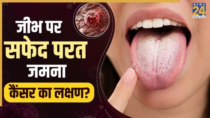 Cancer Symptoms On Tongue