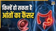 Colorectal Cancer Risk