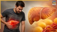 Fatty Liver