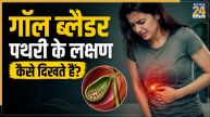 Gallbladder Stones Symptoms