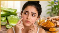 Aloevera And Turmeric For Acne Treatment