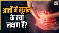 Intestine Swelling Inflammatory bowel disease IBD