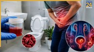 Blood In Urine