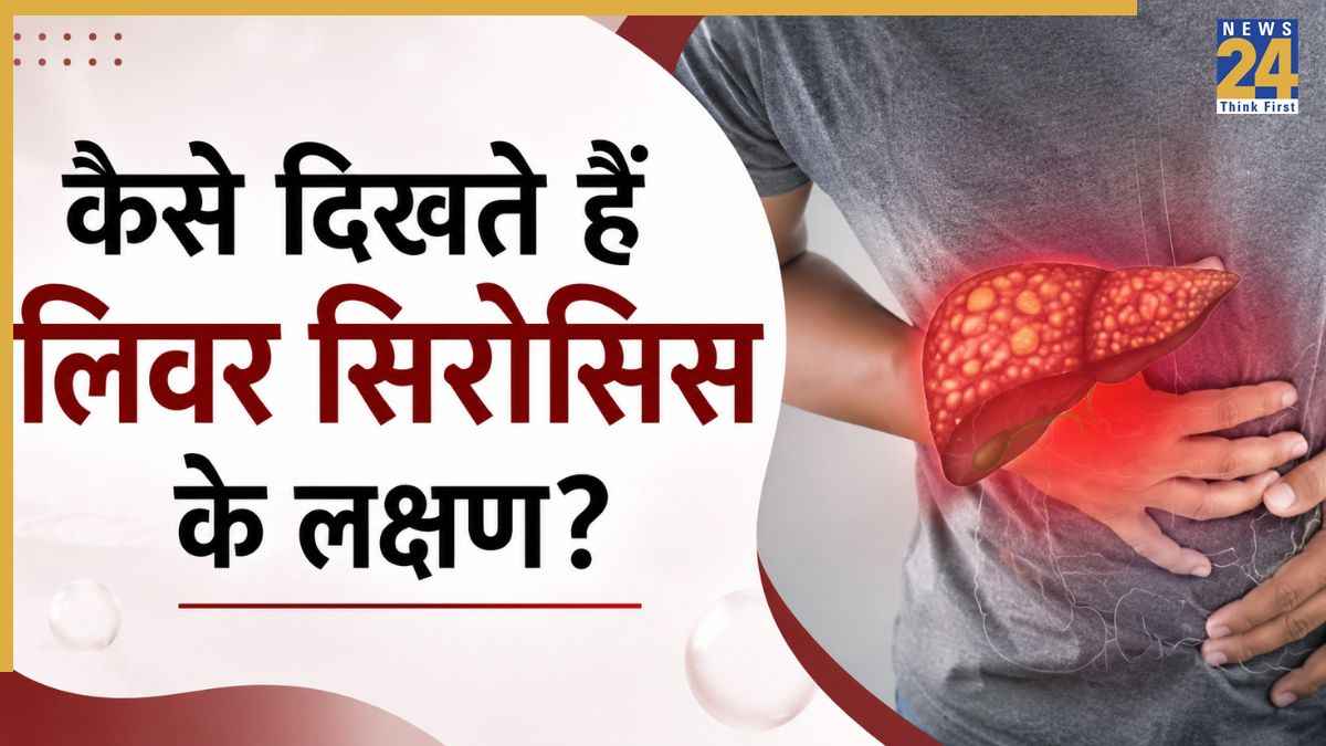 Liver Cirrhosis