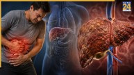 Acute On Chronic Liver Failure Symptoms