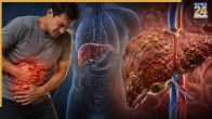 Acute On Chronic Liver Failure Symptoms