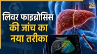 Liver fibrosis Test