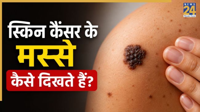 Early Signs Of Skin Cancer