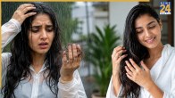 Monsoon Hair Fall Causes