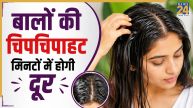 Oily Hair