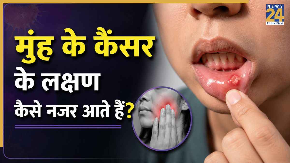 Oral Cancer Signs