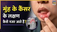 Oral Cancer Signs