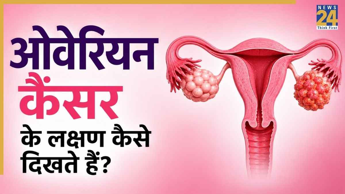 स्टेज 1 ओवेरियन कैंसर के क्या लक्षण होते हैं? जानिए महिलाओं में अंडाशय कैंसर के क्या संकेत दिखते हैं