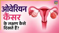 Ovarian Cancer