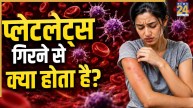 What is the platelet count for dengue