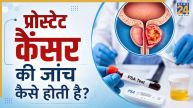 Prostate Cancer Test