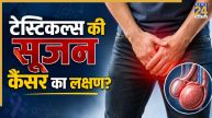 Testicular Cancer Symptoms