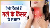 Throat Cancer Signs