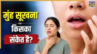 Dry Mouth Causes