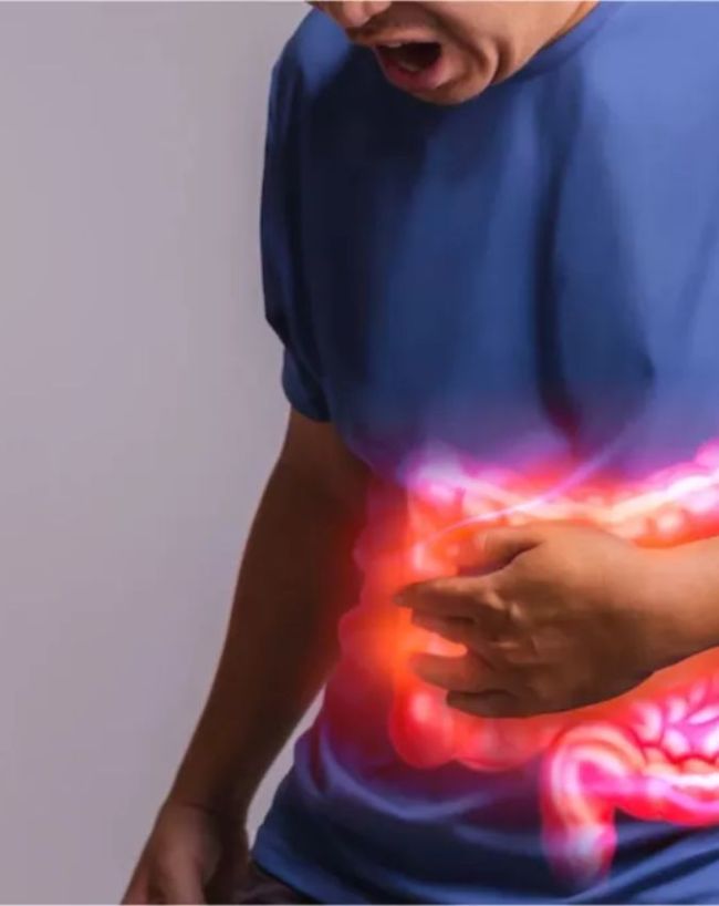 Mouth Ulcers-1-2-3-4-5