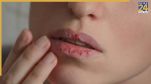 Monsoon Special For Dry Lips