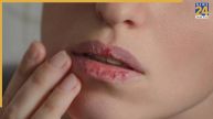 Monsoon Special For Dry Lips