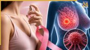 Breast Cancer Myth aiims doctor clear