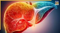 Fatty Liver Foods