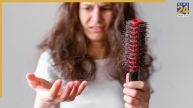 Hair Fall During Monsoon