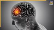 Which foods increase brain health