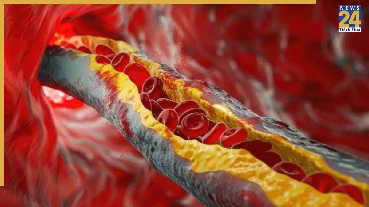 क्या वाकई लहसुन खाने से कोलेस्ट्रॉल कम होता है? NCBI की रिसर्च में सामने आई सच्चाई